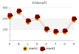 buy sildenafil 75 mg low price