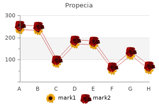 order propecia 5 mg free shipping