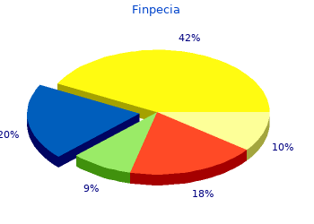buy finpecia 1 mg on-line